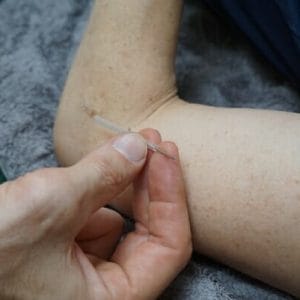 Precise Points Dry Needling for Remedial Massage Therapists