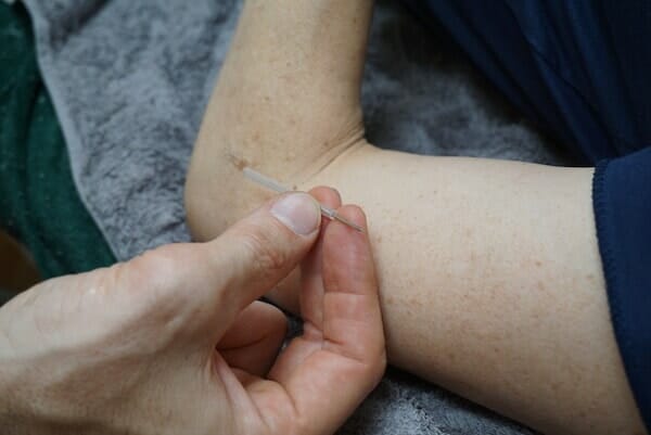 https://ecxkrsf86jo.exactdn.com/wp-content/uploads/Precise-Points-Dry-Needling-for-Remedial-Massage-Therapists-new.jpg?strip=all&lossy=1&ssl=1